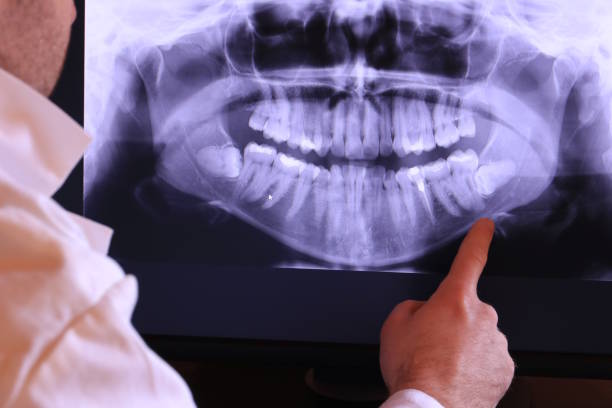 Best Orthodontic Emergency Dentist in Naranja, FL